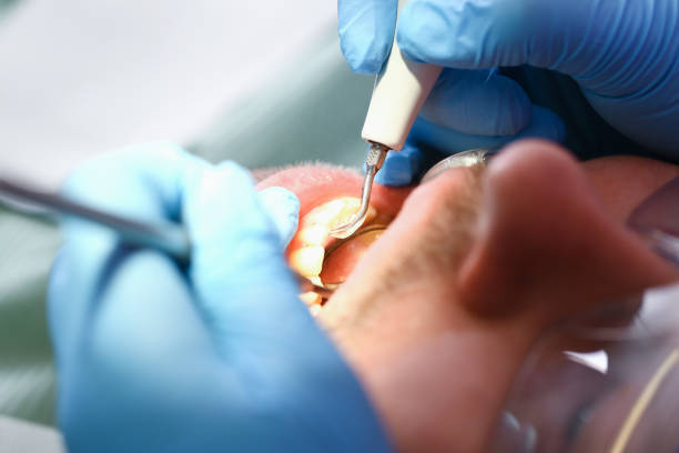 Best Emergency Gum Treatment in Huachuca City, AZ